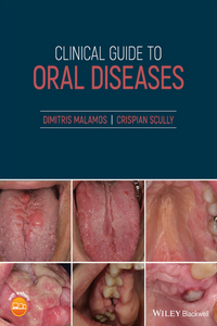 Clinical Guide to Oral Diseases