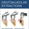 Principles of Dentoalveolar Extractions