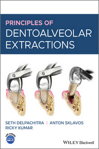 Principles of Dentoalveolar Extractions