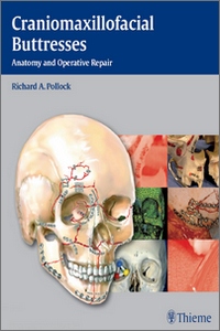 Craniomaxillofacial Buttresses