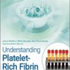 Understanding Platelet-Rich Fibrin