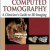 Cone Beam Computed Tomography: A Clinician's Guide to 3d Imaging