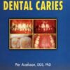 Diagnosis and Risk Prediction of Dental Caries, Volume 2 1st Edition