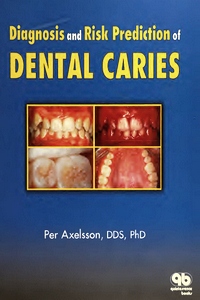 Diagnosis and Risk Prediction of Dental Caries, Volume 2 1st Edition