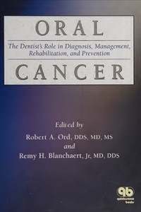 Oral Cancer: The Dentist's Role in Diagnosis, Management, Rehabilitation, and Prevention