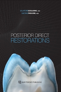 Posterior Direct Restorations