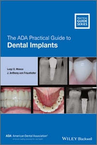 The ADA Practical Guide to Dental Implants