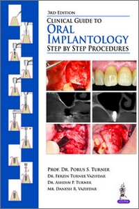 Clinical Guide to Oral Implantology: Step by Step Procedures 3rd edition