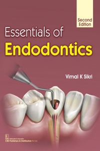 Essentials of Endodontics, 2nd Edition