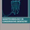 Nanotechnology in Conservative Dentistry