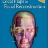 Local Flaps in Facial Reconstruction, 4th Edition