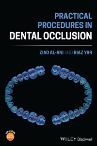 Practical Procedures in Dental Occlusion