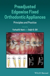 Preadjusted Edgewise Fixed Orthodontic Appliances Principles and Practice