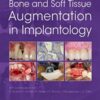 Bone and Soft Tissue Augmentation in Implantology