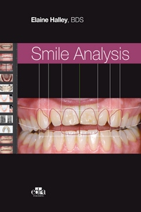 SMILE ANALYSIS (Elaine Halley)