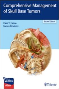 Comprehensive Management Of Skull Base Tumors, 2nd Edition