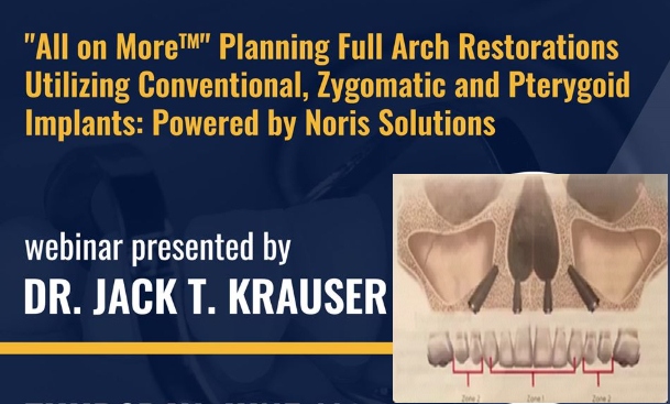 Planning Full Arch Restorations Utilizing Conventional Zygomatic and Pterygoid Implants