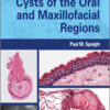 Shear's Cysts of the Oral and Maxillofacial Regions, 5th Edition