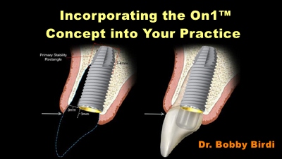 Incorporating the On1™ Concept into Your Practice