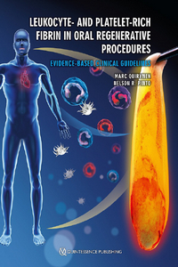 Leukocyte- and Platelet-Rich Fibrin in Oral Regenerative Procedures: Evidence-Based Clinical Guidelines