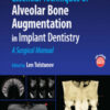 Essential Techniques of Alveolar Bone Augmentation in Implant Dentistry: A Surgical Manual, 2nd Edition