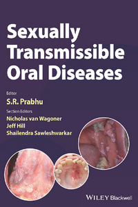 Sexually Transmissible Oral Diseases