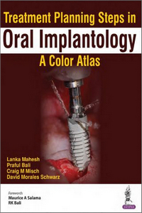 Oral Submucous Fibrosis: A Guide to Diagnosis and Management