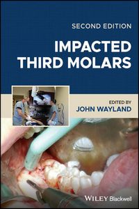 Impacted Third Molars, 2nd Edition