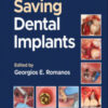 Saving Dental Implants