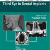 Dental CT: Third Eye in Dental Implants