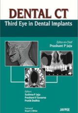 Dental CT: Third Eye in Dental Implants