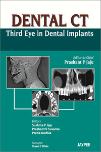 Dental CT: Third Eye in Dental Implants