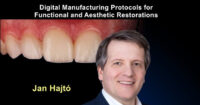 Anterior Veneers: Digital Manufacturing Protocols for Functional and Aesthetic Restorations