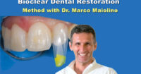 Bioclear Dental Restoration