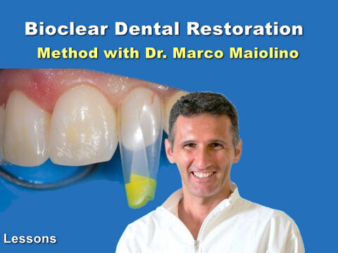 Bioclear Dental Restoration