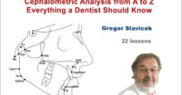 Cephalometric Analysis from A to Z: Everything a Dentist Should Know