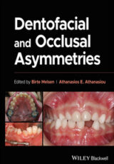 Dentofacial and Occlusal Asymmetries