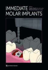 Immediate Molar Implants