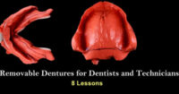 Removable Dentures for Dentists and Technicians