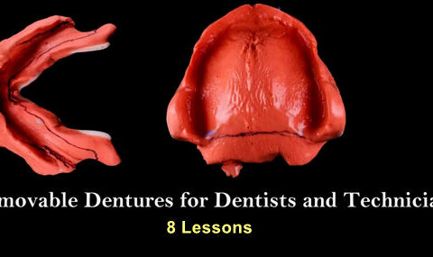 Removable Dentures for Dentists and Technicians