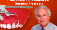 Advanced Periodontology Surgical Protocols (Video Course)