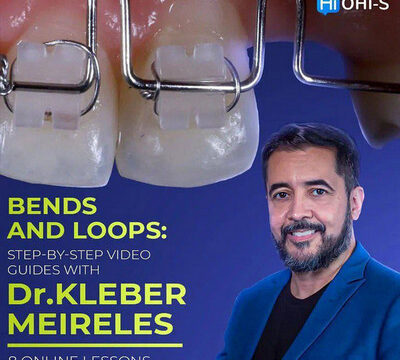 Bends and Loops: Step-by-step Video Guides with Dr. Kleber Meireles