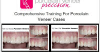 Porcelain Veneer Precision: Comprehensive Training for Porcelain Veneer Cases