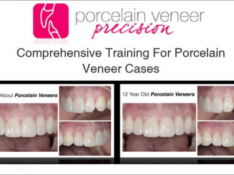 Porcelain Veneer Precision: Comprehensive Training for Porcelain Veneer Cases