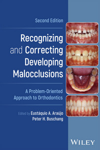 Recognizing and Correcting Developing Malocclusions: A Problem‐Oriented Approach to Orthodontics, 2nd Edition