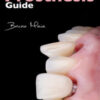 Implant-Supported Prosthesis Guide