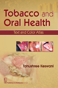 Tobacco and Oral Health: Text and Color Atlas