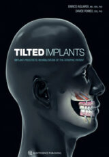 Tilted Implants: Implant-Prosthetic Rehabilitation of the Atrophic Patient